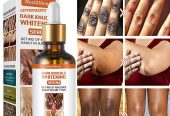 Dark Knuckle Whitening Serum In Kiffa Town in Mauritania Hand Elbow Knee Brightening Serum In Quriyat Town in Oman Call ☏ +2771 073 2372 Get Rid Of Vitiligo In Vaasa City In Finland, Scars And Stretch Marks In Polokwane City, Tattoo Removal In Saldanha Town And Vereeniging City In South Africa