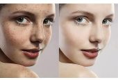 Permanent Skin Bleaching And Whitening Products In Plettenberg Bay And Beaufort West Call ☏ +27710732372 Scars And Stretch Marks Removal Cream In Rustenburg And Louis Trichardt South Africa