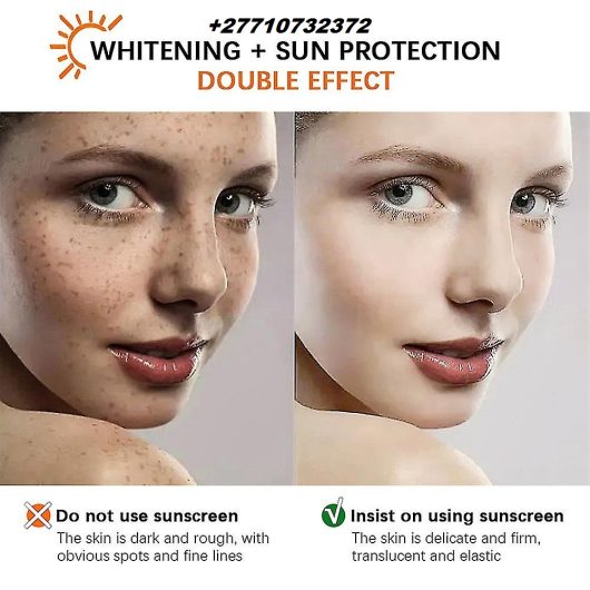 Permanent Skin Bleaching And Whitening Products In Plettenberg Bay And Beaufort West Call ☏ +27710732372 Scars And Stretch Marks Removal Cream In Rustenburg And Louis Trichardt South Africa