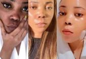 Kojic acid for skin lightening & prevent skin pigmentation +27 81 850 2816 Mahikeng, Lichtenburg, Coligny