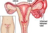 Female vaginal health , vaginal tightening herbs +27 63 034 8600