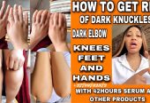 Dark Knuckle Whitening Serum In Kiffa Town in Mauritania Hand Elbow Knee Brightening Serum In Quriyat Town in Oman Call ☏ +2771 073 2372 Get Rid Of Vitiligo In Vaasa City In Finland, Scars And Stretch Marks In Polokwane City, Tattoo Removal In Saldanha Town And Vereeniging City In South Africa